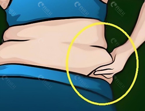 彭家乐做超声乳化吸脂瘦腰腹技术怎么样？