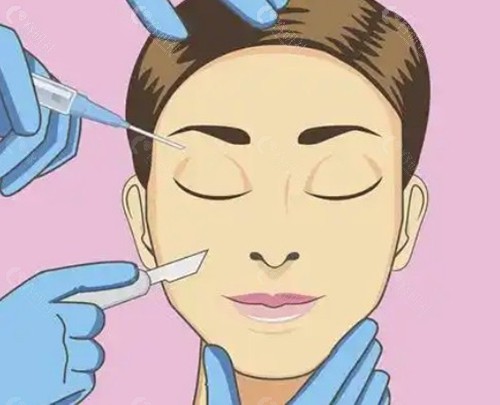 提眉和双眼皮可以一起做吗？