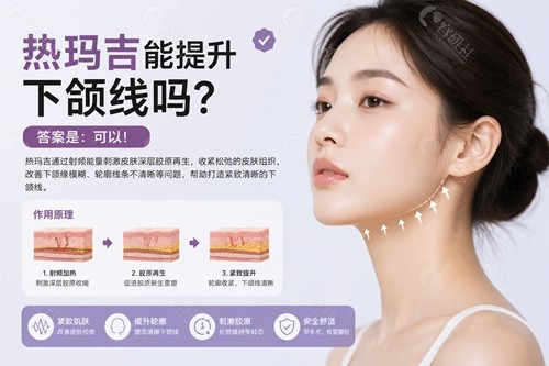 热玛吉能提升下颌线吗？