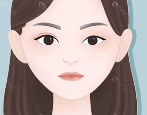 双眼皮松解 VS 双眼皮松单：核心技术差异全解析