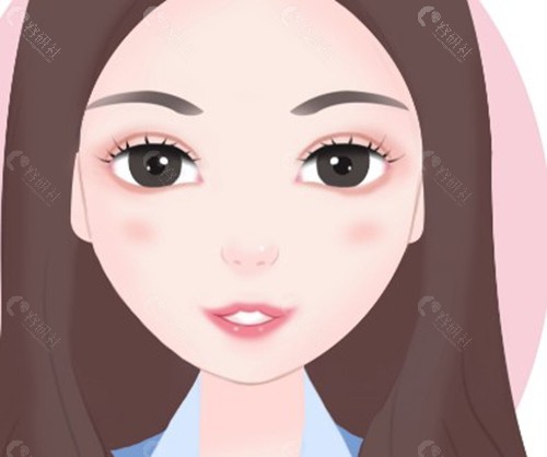 欧阳帆医生做双眼皮的核心技术特色 欧阳帆医生做双眼皮的核心技术特色