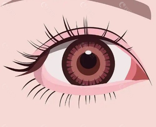 成都西婵眼整形四大代表医生核心技术与风格测评 成都西婵眼整形四大代表医生核心技术与风格测评