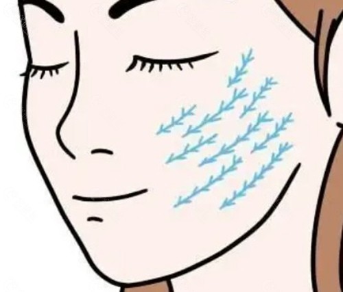 王春虎苹果肌悬吊手术的核心技术特色