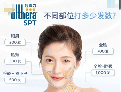 美版超声刀全脸打多少发比较好？