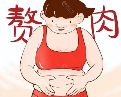 腹部吸脂后到底会不会反弹? 腹部吸脂后到底会不会反弹?