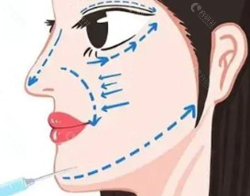 北京漾格打玻尿酸价格 北京漾格打玻尿酸价格