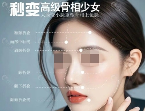 戴柳丽医生做微整注射好吗 戴柳丽医生做微整注射好吗