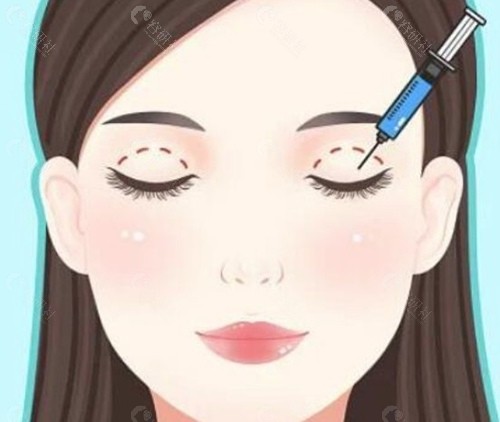苏州维多利亚做眼睛价格参考 苏州维多利亚做眼睛价格参考