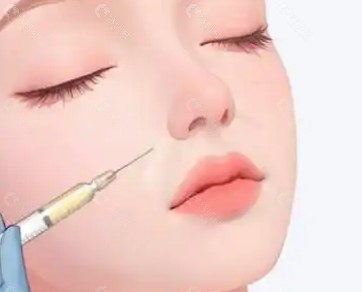 骨膜层容量填充的原理:从“填”到“撑”的变化 骨膜层容量填充的原理:从“填”到“撑”的变化