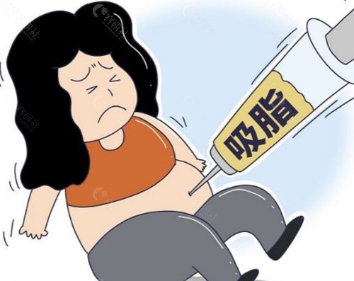 李增辉医生吸脂手术特色 李增辉医生吸脂手术特色