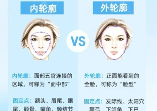 幼态脸填充用什么材料不移位和下垂？骨水泥填充颅顶、额头后脑勺持久好评多