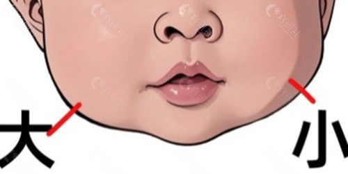 孩子大小脸通常是由什么原因引起的? 孩子大小脸通常是由什么原因引起的?