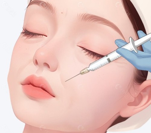 韩国四大口碑皮肤科:骨相注射的技术特色 韩国四大口碑皮肤科:骨相注射的技术特色