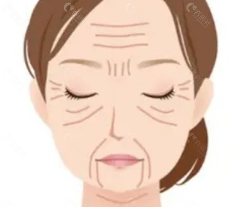 骨膜层填充和普通的浅层填充有什么区别? 骨膜层填充和普通的浅层填充有什么区别?