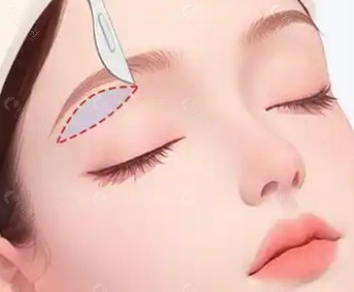 韩国五大口碑抗衰机构及提眉特色解析 韩国五大口碑抗衰机构及提眉特色解析