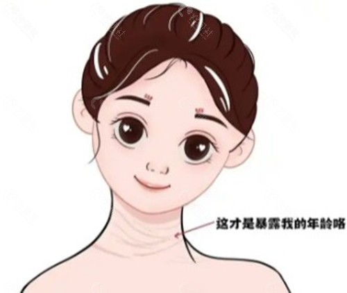 北京颈阔肌折叠术医生排名 北京颈阔肌折叠术医生排名