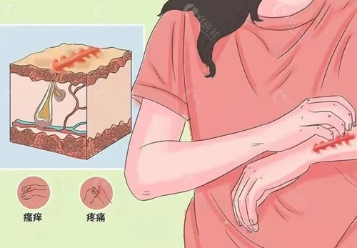 揭阳安淇医美整形祛疤痕好吗 揭阳安淇医美整形祛疤痕好吗