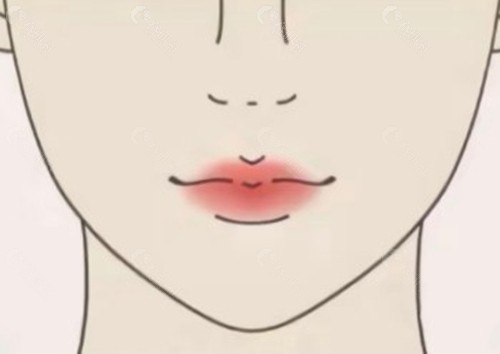 怎么判断自己是不是真正的“咬肌肥大”? 怎么判断自己是不是真正的“咬肌肥大”?
