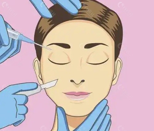 为什么眉下切口提眉术如此考验医生功课？
