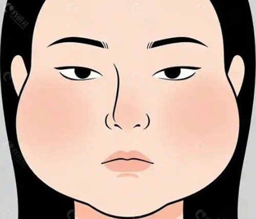 裴晶晶“面部减容三件套”的核心逻辑 裴晶晶“面部减容三件套”的核心逻辑