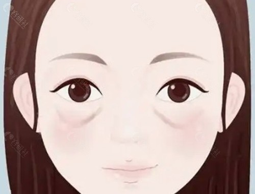 陈向东做眼周抗衰靠谱吗？