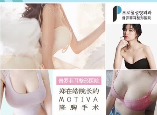 韩国普罗菲耳整形医院胸部整形好吗