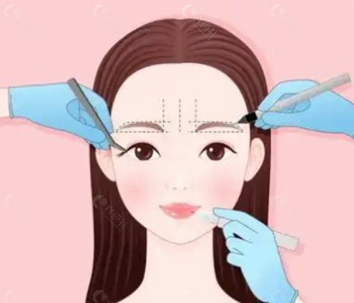韓國臥蠶手術的常見方式與價格行情 韓國臥蠶手術的常見方式與價格行情