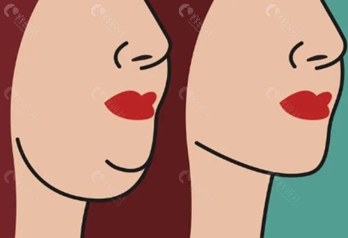 下巴肌肉会松弛如何改善? 下巴肌肉会松弛如何改善?