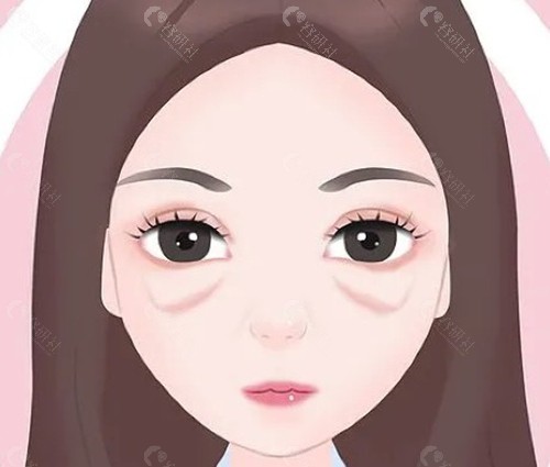  2026年美诗沁去眼袋真实收费参考