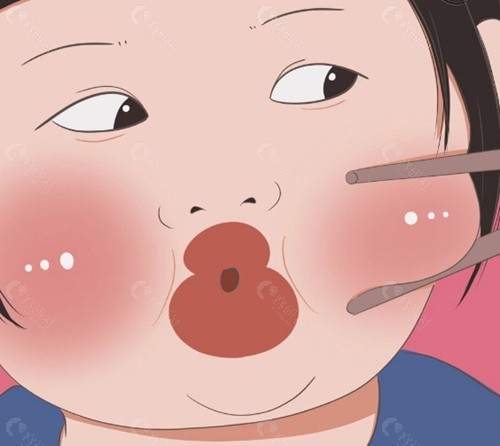 双下巴做吸脂还是溶脂好