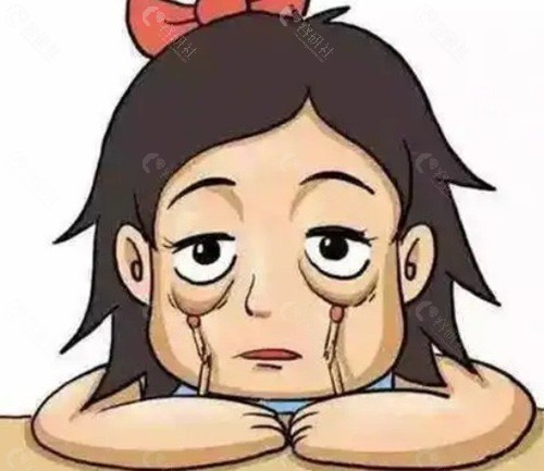 眼窝填充自体脂肪可以维持多久？  