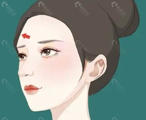 揭晓真相:无痕筋膜提升到底是全麻还是局麻? 揭晓真相:无痕筋膜提升到底是全麻还是局麻?