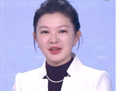 王昊注射玻尿酸好吗 王昊注射玻尿酸好吗