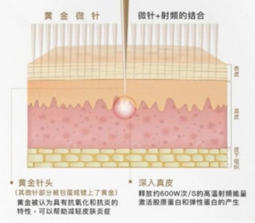 韩国黄金微针热门口碑机构及其特色解析 韩国黄金微针热门口碑机构及其特色解析