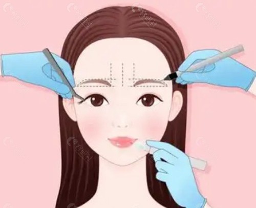 超羽翼提升是什么项目？