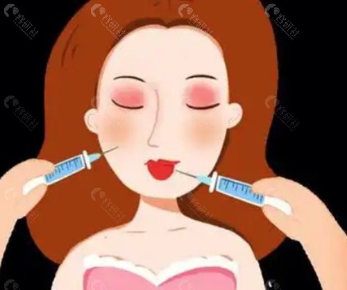 苹果肌复位打哪种玻尿酸好?材料理化特性硬核拆解 苹果肌复位打哪种玻尿酸好?材料理化特性硬核拆解