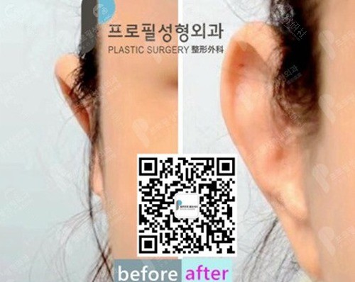 韩国普罗菲耳郑在皓院长预约指南