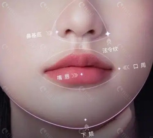 为什么口周衰老那么难缠？口周年轻化包含什么？
