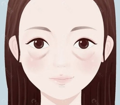 薛文静眼周黑绷带分层抗衰怎么样？