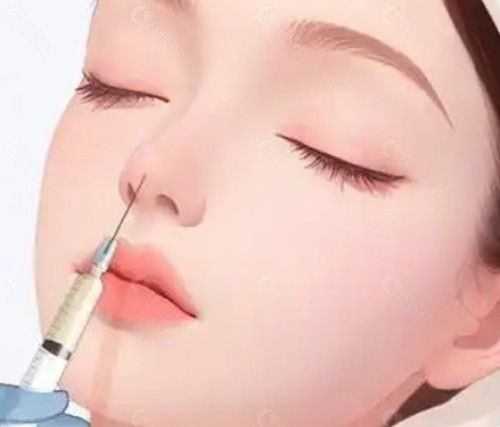 谷晓红鼻部注射技术到底好不好？
