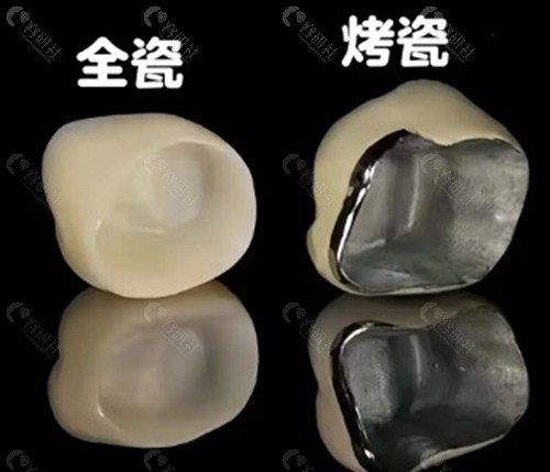 网上600元、1000元的全瓷牙,敢做吗? 网上600元、1000元的全瓷牙,敢做吗?