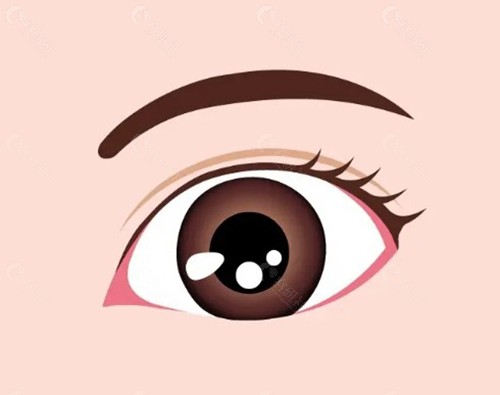 如何选择适合自己的上眼皮松弛矫正方案？