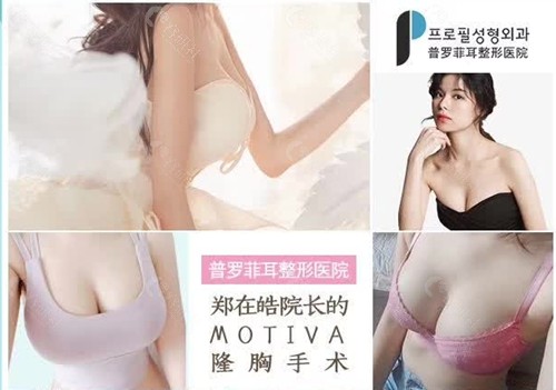 韩国普罗菲耳（Profile）整形外科假体隆胸好吗