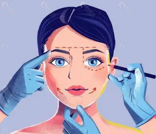 重庆曹美三维立体注射抗衰技术特色 重庆曹美三维立体注射抗衰技术特色