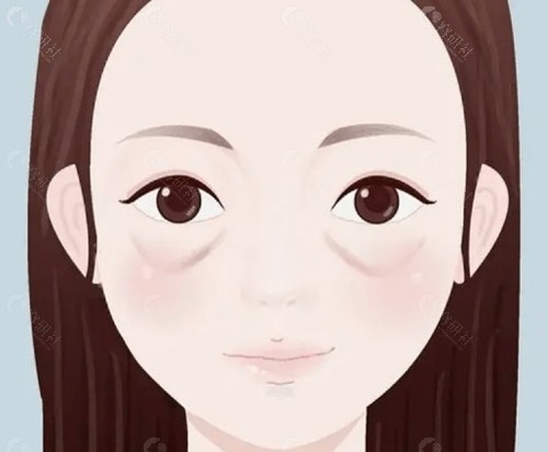 7C眶周年轻化到底打什么材料？