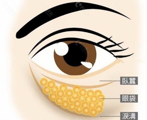 审美与技术壁垒：为什么他的眼周抗衰不“馒化”？