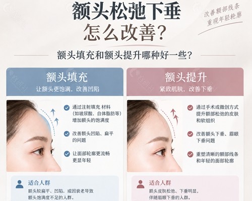 额头松弛下垂怎么改善?额头填充和额头提升哪种好一些? 额头松弛下垂怎么改善?额头填充和额头提升哪种好一些?