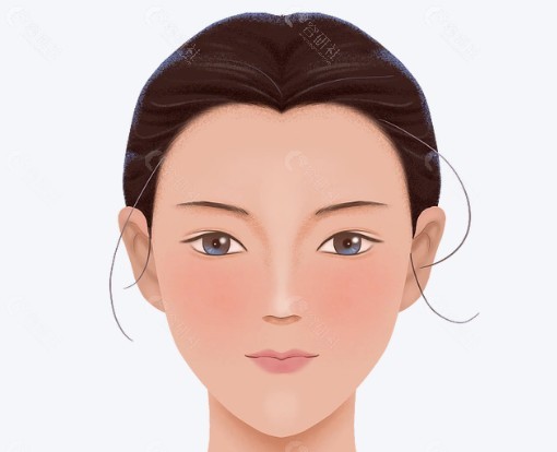 骨骼重塑：双鄂手术是如何让面中部“变短”的？
