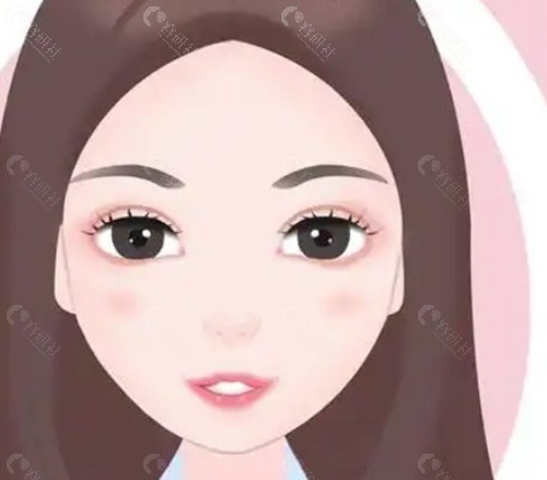 定点双眼皮 VS 全切双眼皮:核心区别在哪里? 定点双眼皮 VS 全切双眼皮:核心区别在哪里?
