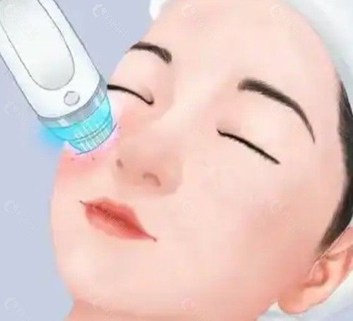 做黃金微針，真的有必要去韓國嗎？